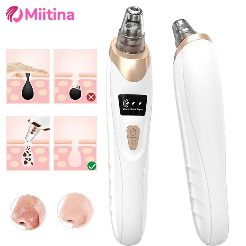 Zayyanun® Professional  5 in 1  Electric Blackhead Remover with USB Charging