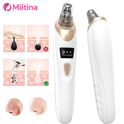 Zayyanun® Professional  5 in 1  Electric Blackhead Remover with USB Charging